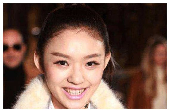 3,牙齿不能太黄太乱,最好也不要太小颗,一口糯米牙笑起来也会显得不够