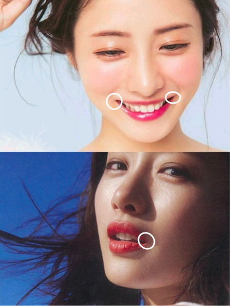 凭什么明星的龅牙凸嘴笑起来就比普通人好看?