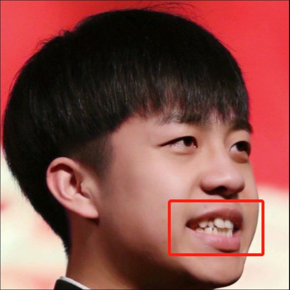 因为最_圈子-新氧美容整形