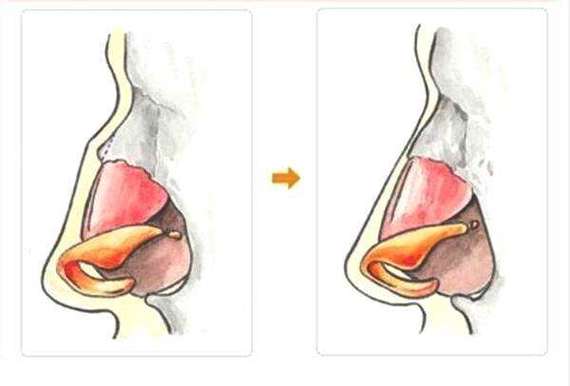 圈子-新氧美容整形