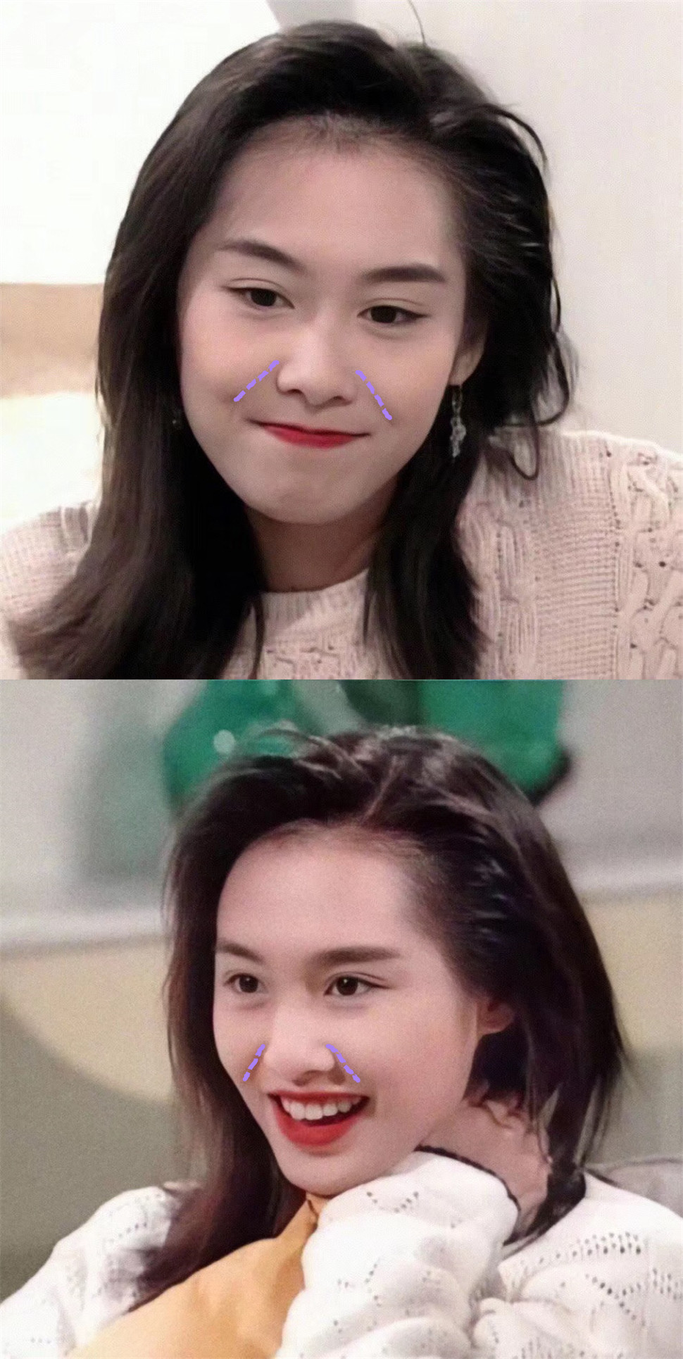 为什么有些人有八字纹照样灵动可爱!