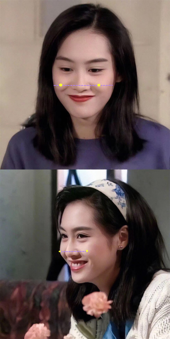 为什么有些人有八字纹照样灵动可爱!