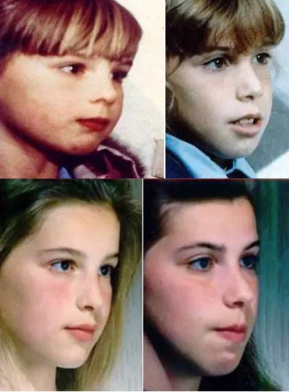 mew体态训练法,通过习惯训练,改变口呼吸所带来的口呼吸面容,以及下巴