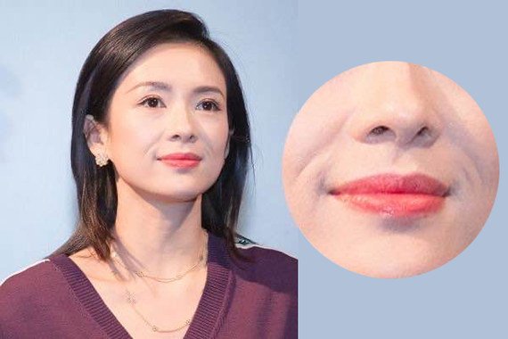 对于面部,你最头疼的部位是什么?