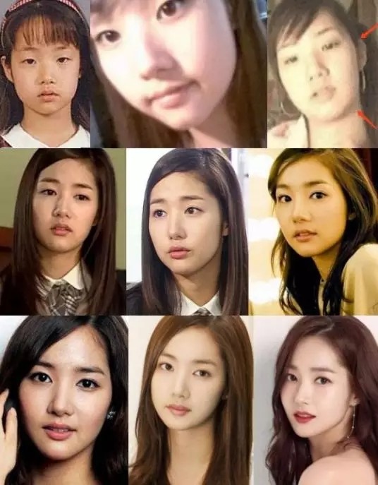 整容之成功,号称南韩换头第一人!