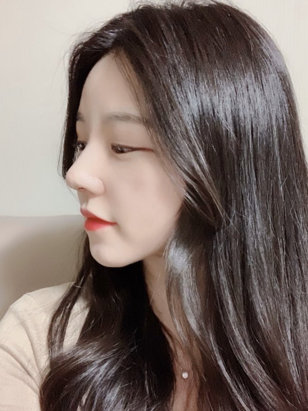 做了鼻综合,我的颜值趋于完美了-一个鼻子拯救一张脸_圈子-新氧美容