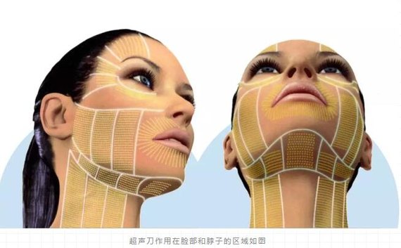 做了筋膜悬吊后悔死了 _圈子-新氧美容整形