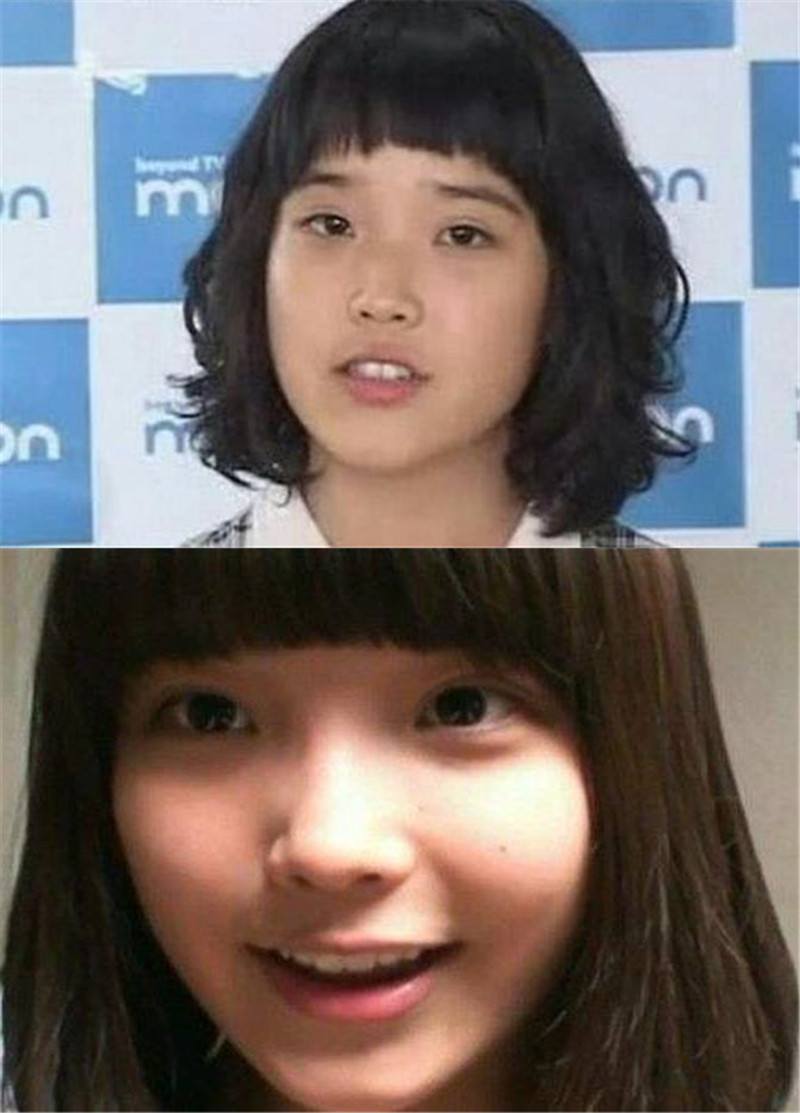 五官那么平淡的iu,也是整出来的?==之前一直不觉_圈子-新氧美容整形