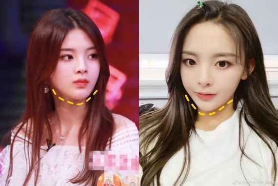 杨超越整牙后终于可以放肆海笑了