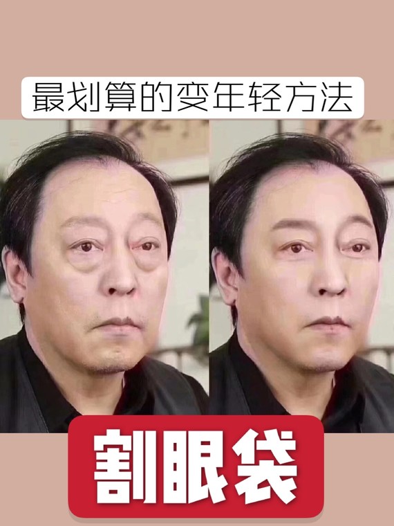 还记得那些年可以帅过吴彦祖的苏大强吗