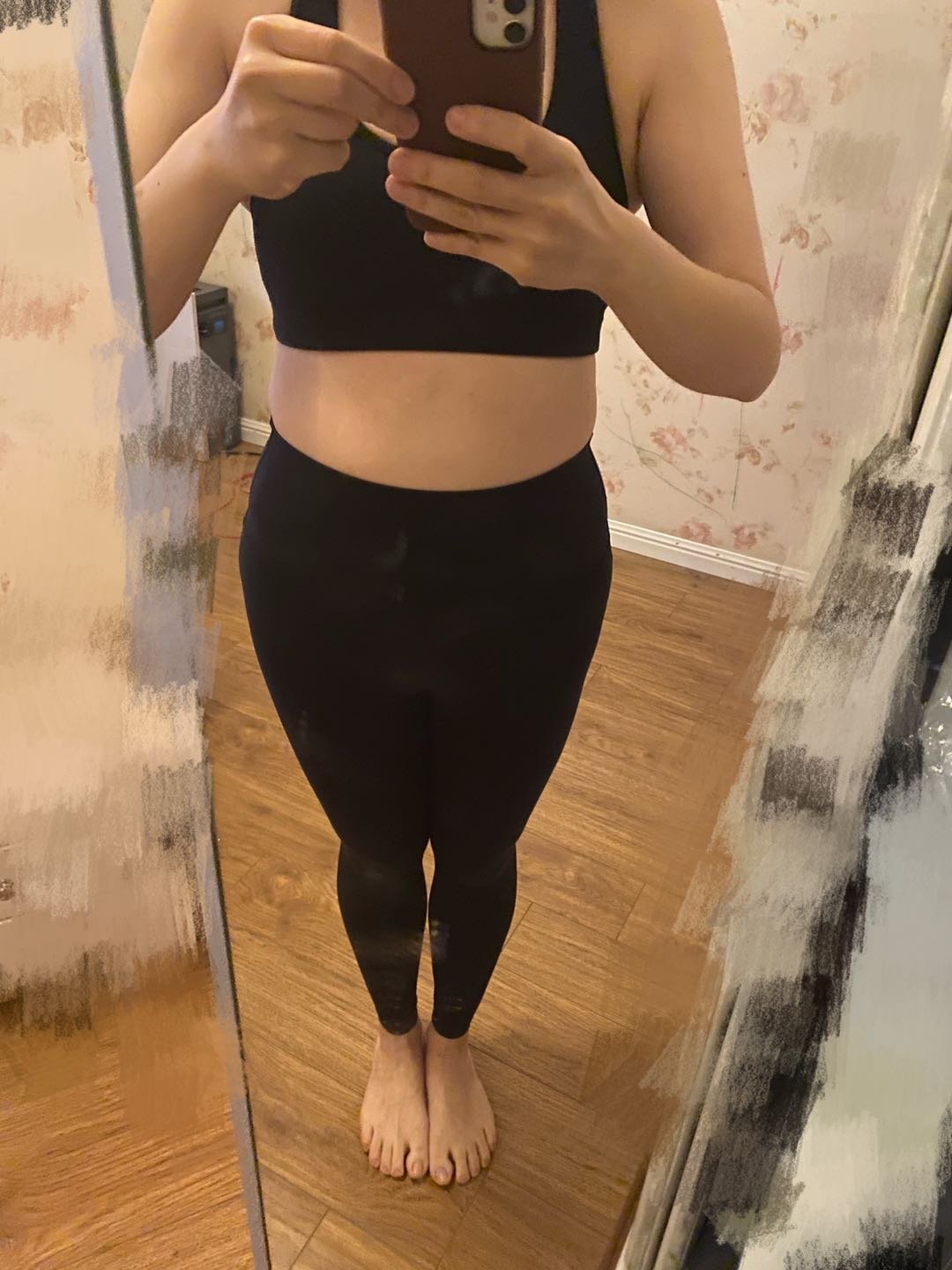 身高:165cm 体重:115斤 腰围:75cm _圈子-新氧美容整形