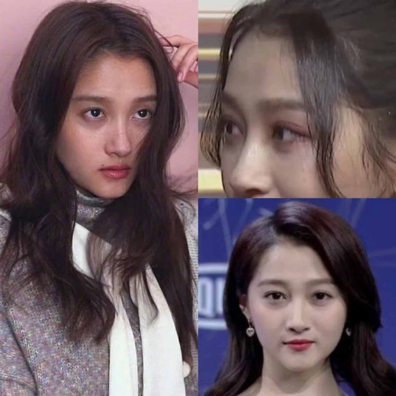 连关晓彤也镇不住的黑眼圈,到底该怎么破71前段时间,_圈子-新氧美容