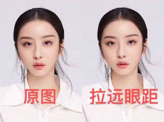 最近鹅看《青春有你2_圈子-新氧美容整形