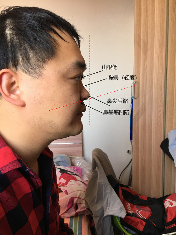 从你提供的照片上,我大概分析了一下