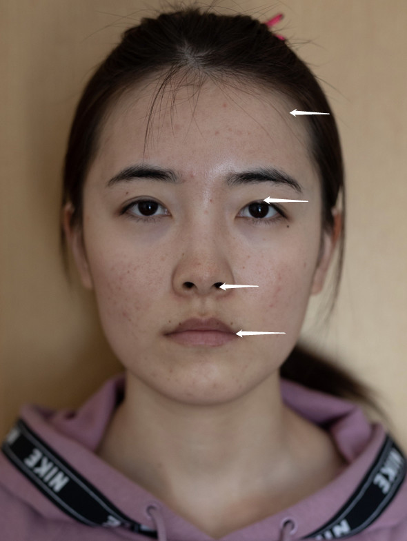 【求看脸】男相头秃,身高和脸不搭,苦相,脸歪线条不流畅的苦恼