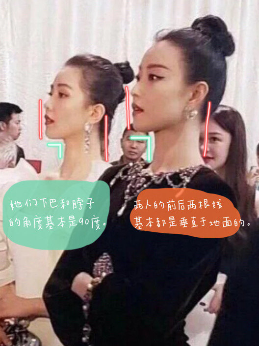 原来它才是我下颌线的最大绊脚石