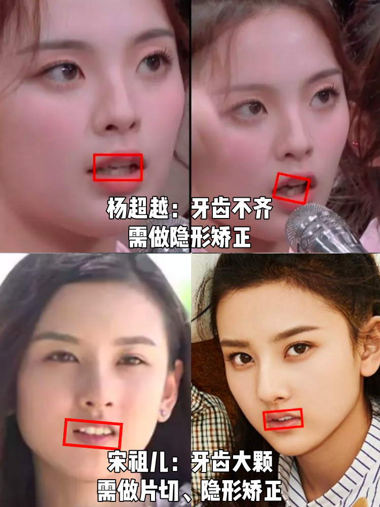 撞宋祖儿和杨超越意外撞脸!竟然是因为小鸡嘴