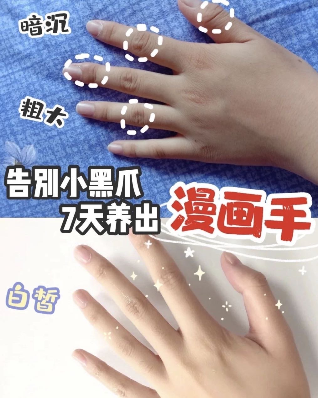 手部问题:关节黑冻伤._圈子-新氧美容整形