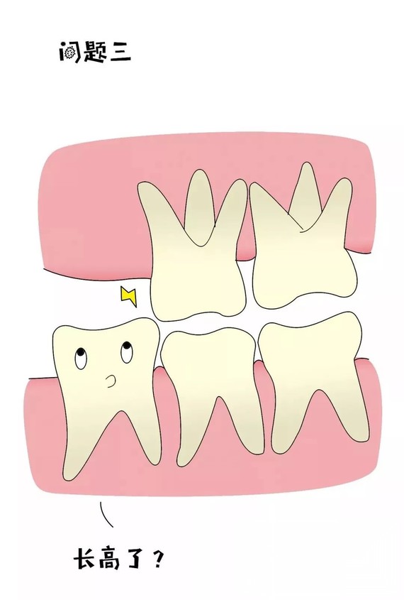 为什么这么多人的智齿都长歪了?