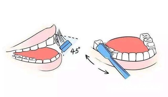 目前国际公认有效的刷牙方式是巴氏刷牙法1