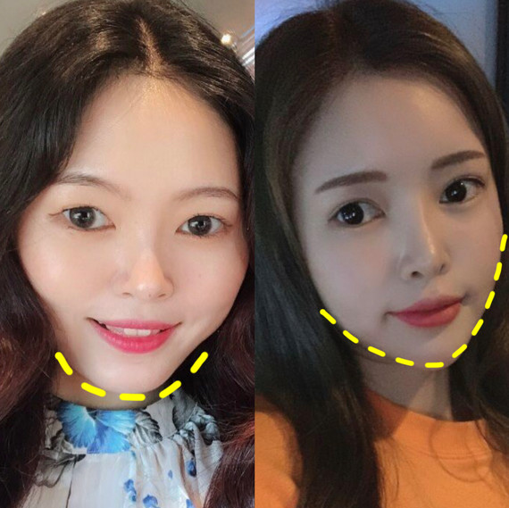 看完这篇你终于知道自己该整哪里了