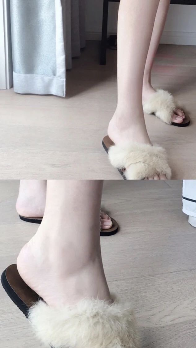 黑脚脖,肿脚背,穿凉鞋不好看的,美足窍门