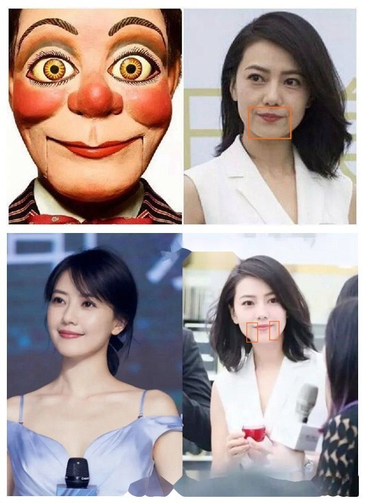 显老元凶不止法令纹注意你的木偶纹