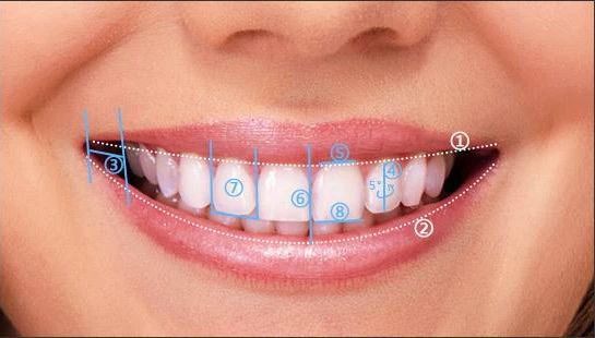 78笑线的立体感:从前向后有轻微的突度的圆弧形,倘若上前牙排列成一