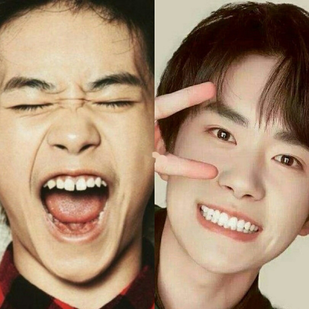 为什么好看的男明星都做牙齿矫正了