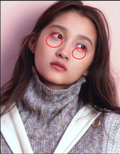 [【黑眼圈拯救计划】长的再美,经不住黑眼圈拉低颜值_圈子-新氧美容