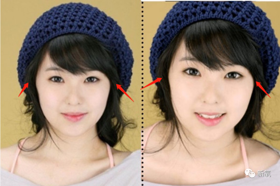 颧弓突出比较好看出,艾琳的颧骨不算鼓,光凭照片不好判断,我们可以