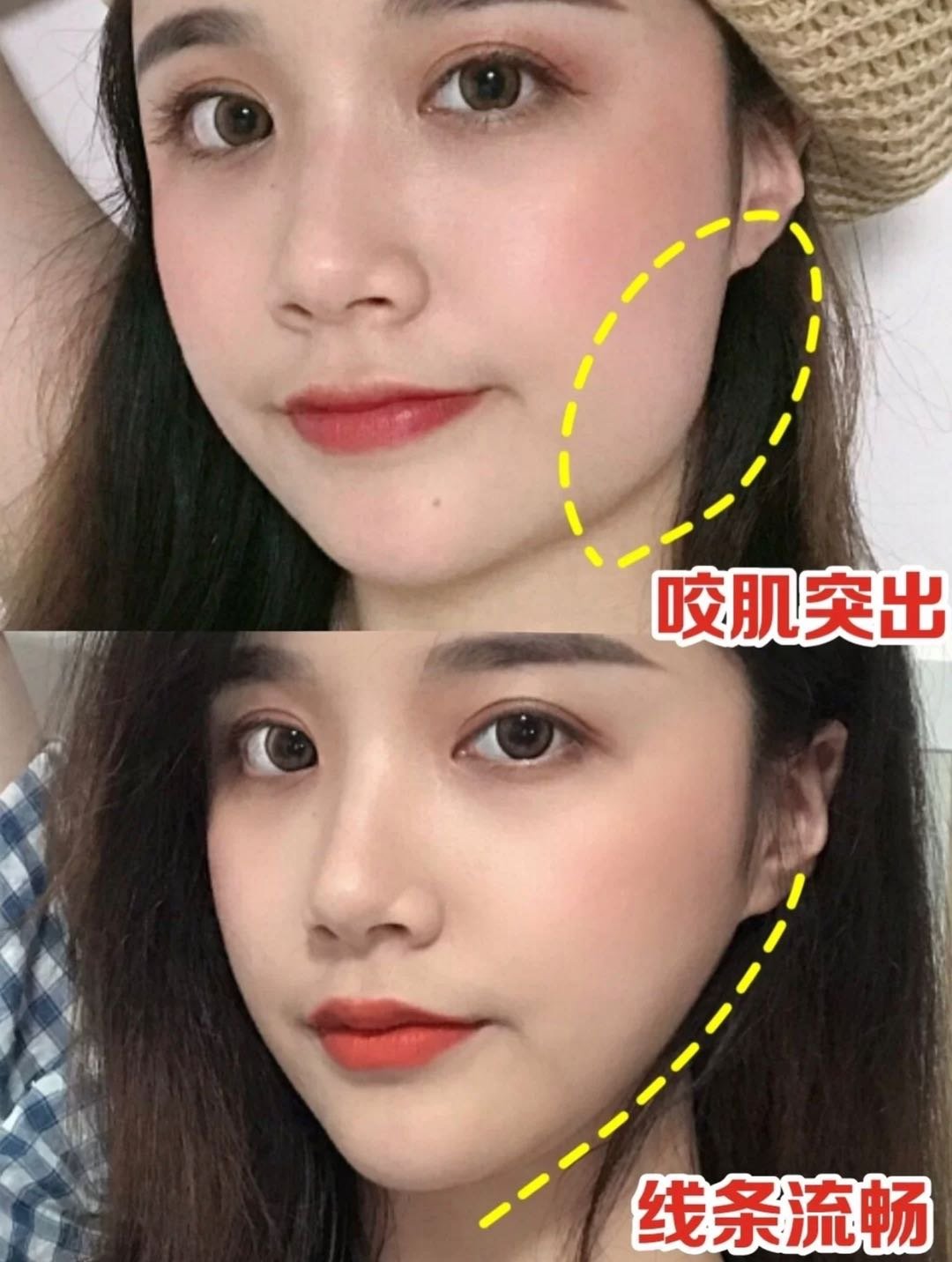 单侧咀嚼咬肌大?这样做练出完美下颌线!