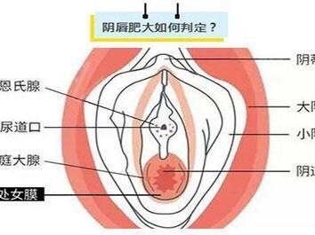 小阴唇肥大的原因是什么