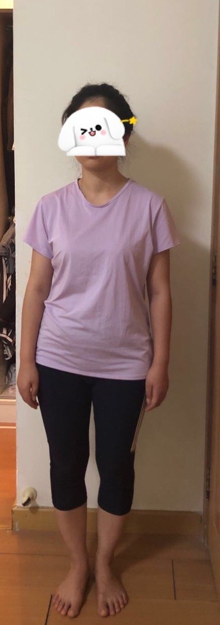 身高159厘米,体重57kg,有肚腩,屁股腿部脂肪_圈子-新氧美容整形
