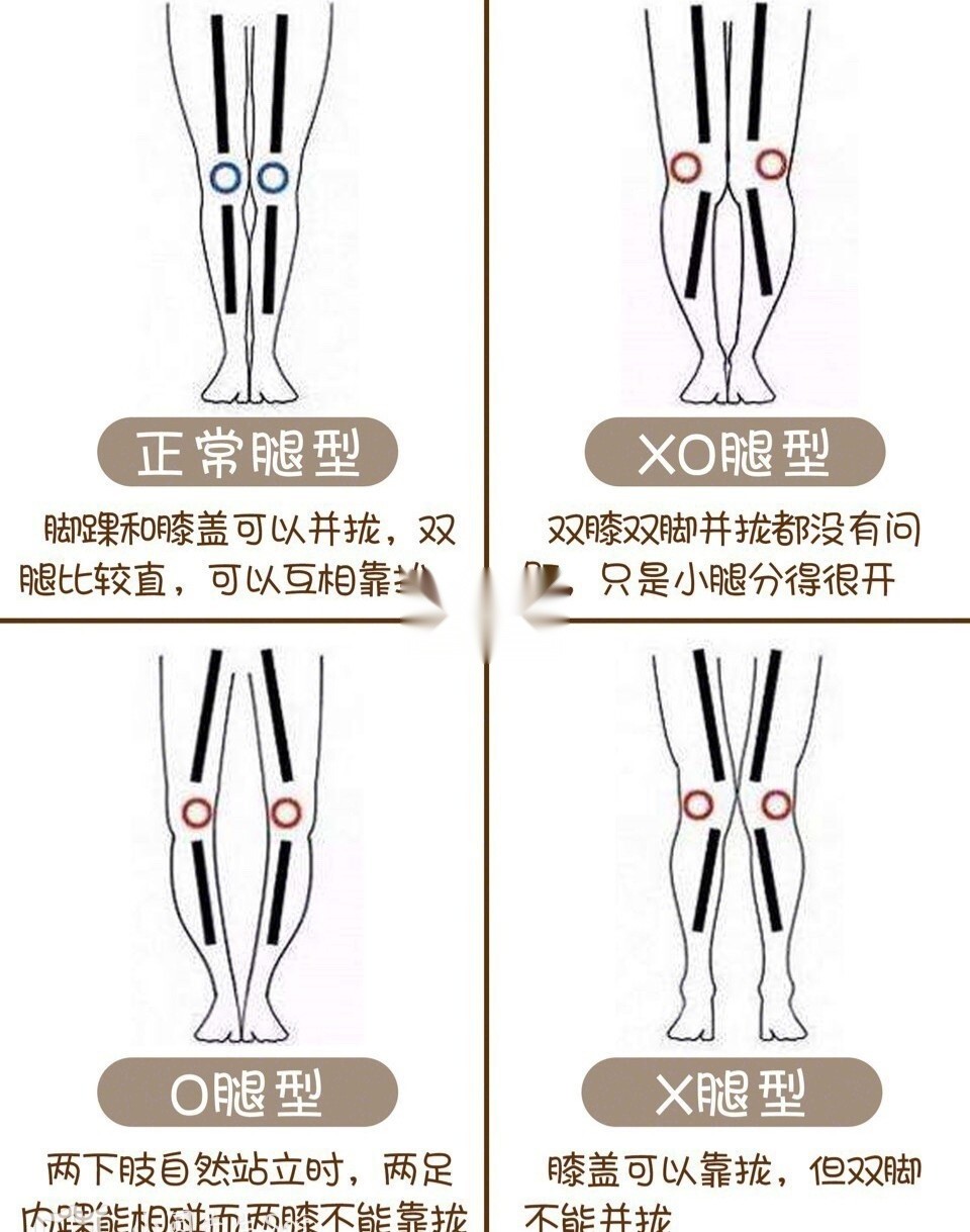 30天轻松改善xo型腿拍照不p图美腿超吸睛