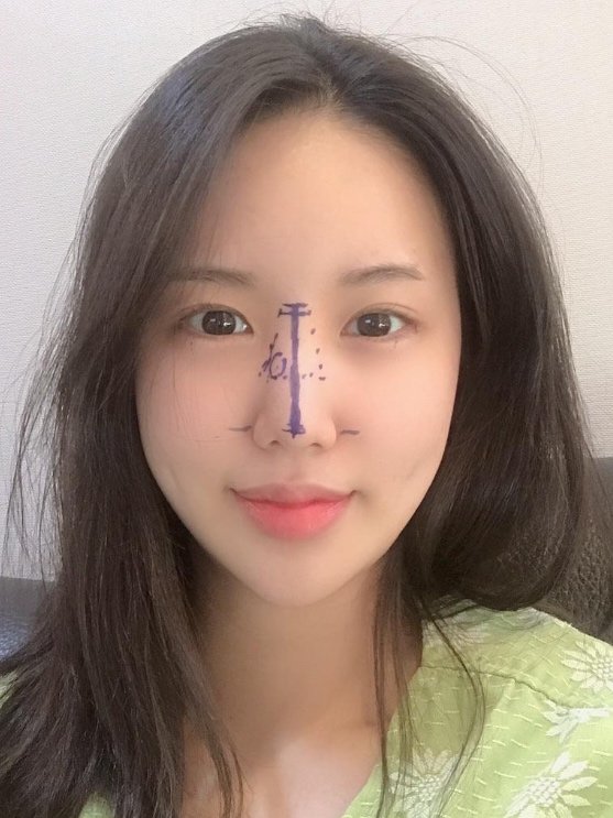 拥有自然又立体的鼻子,改变整张脸!