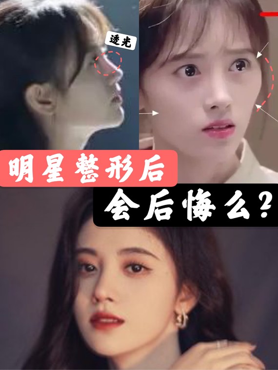 鞠婧祎《请赐我一双翅膀》播出后,被爆出鼻子透光这张_圈子-新氧美容