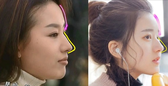 鼻额角较小,有轻微驼峰骨感,高度明确的鼻背,还有侧面清晰的鼻尖表现