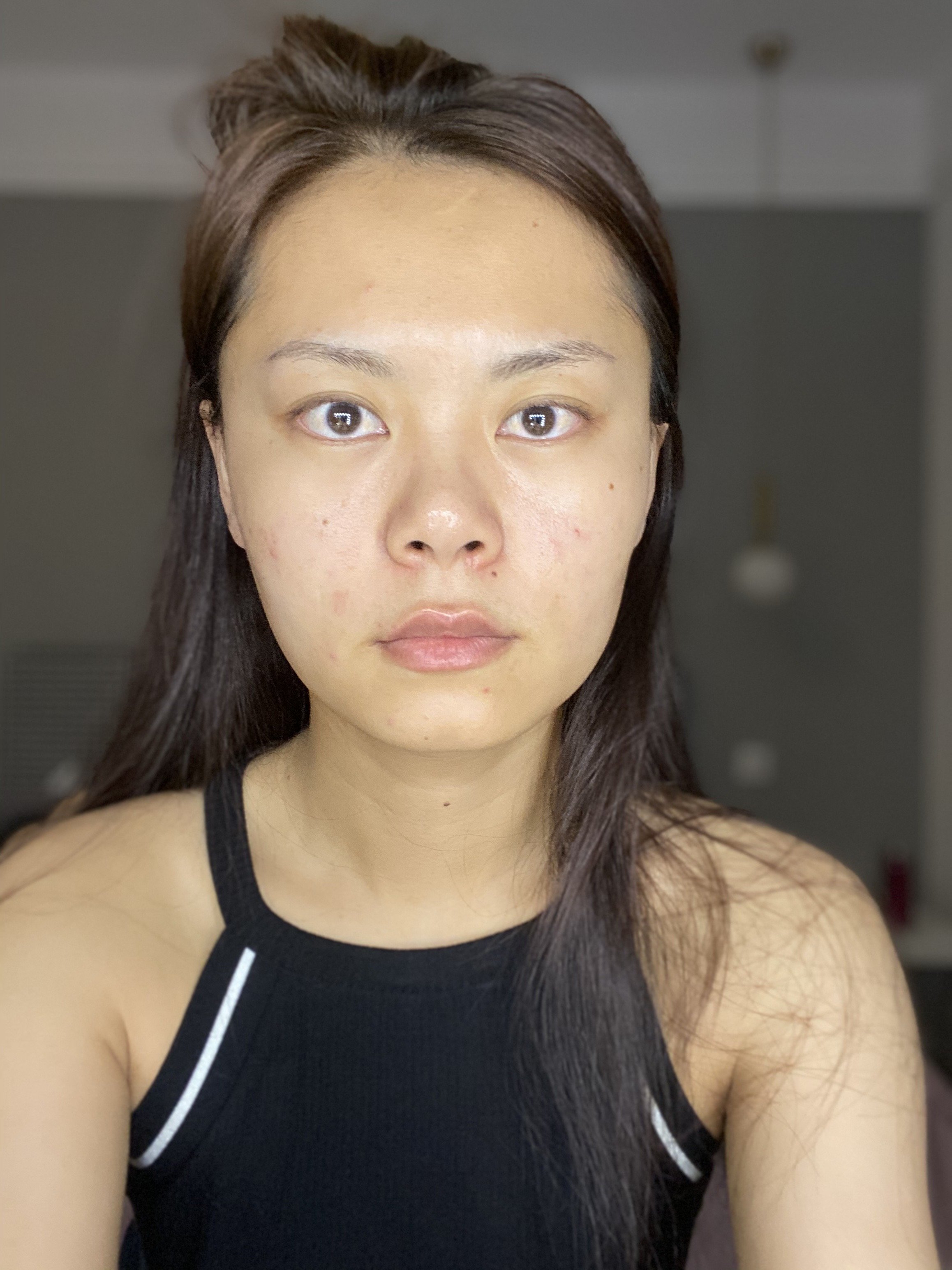 新氧老粉正面看的时候能看到鼻孔鼻子长度特别短没有鼻头这种情况下