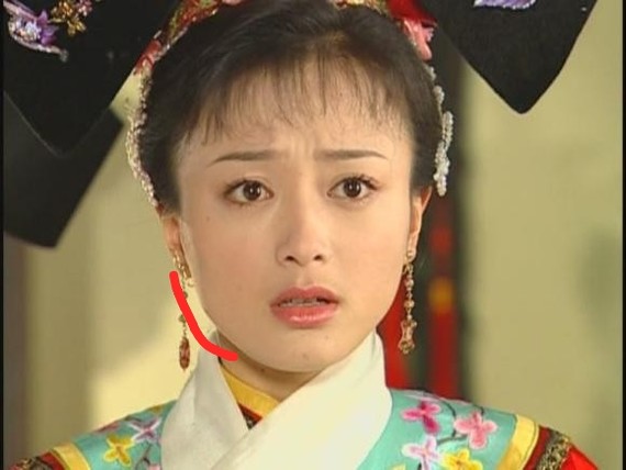 最近,秦岚有两部戏正在热播《怪你过分美丽》和《民初_圈子-新氧美容