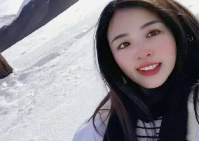 张含韵嘴角歪斜变严重了