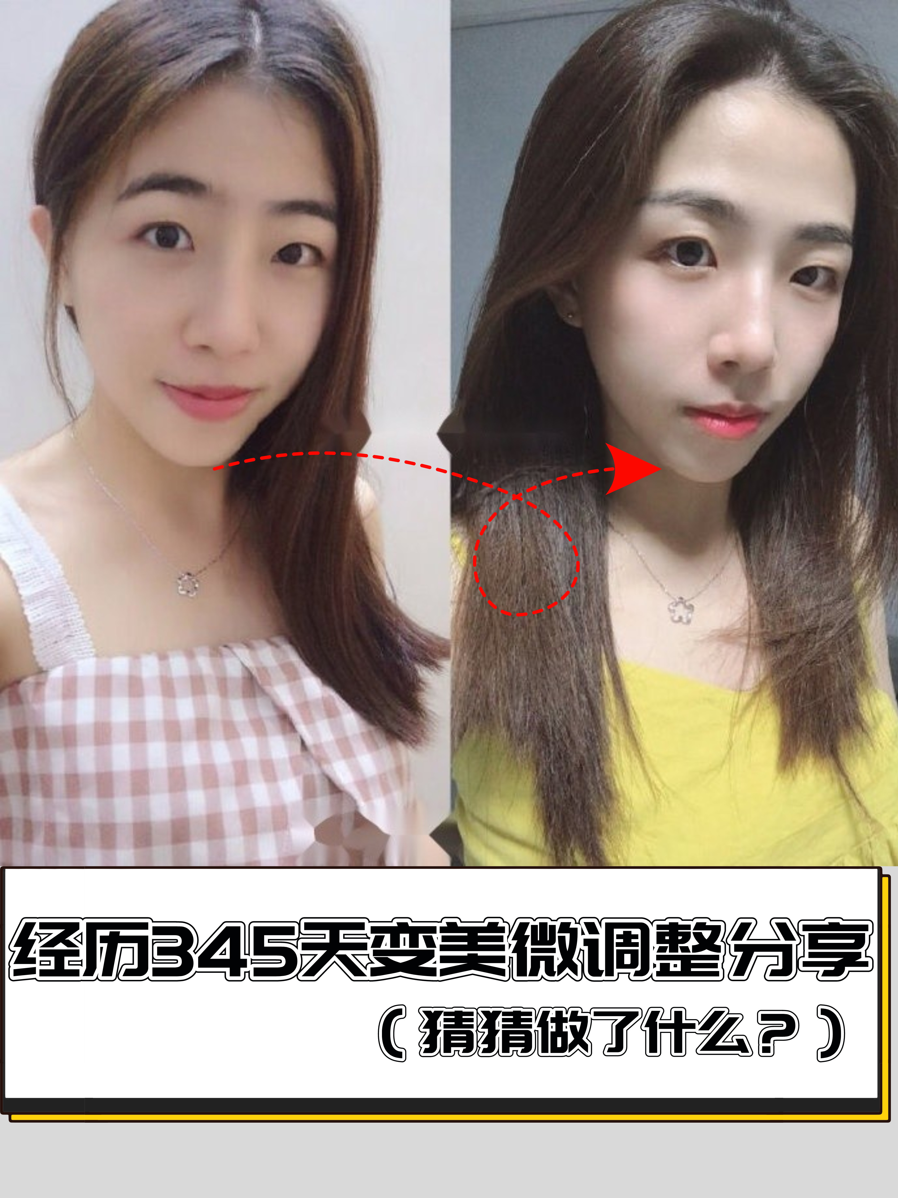 78小姐姐牙齿情况:地包天78放松的时候会闭不上嘴巴78_圈子