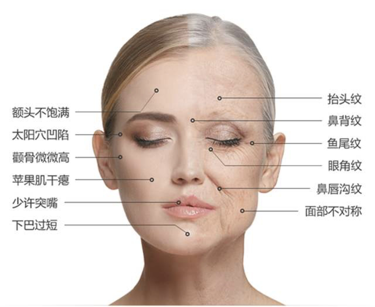 高圆圆也有明显的衰老痕迹了,苹果肌下移加深法令纹