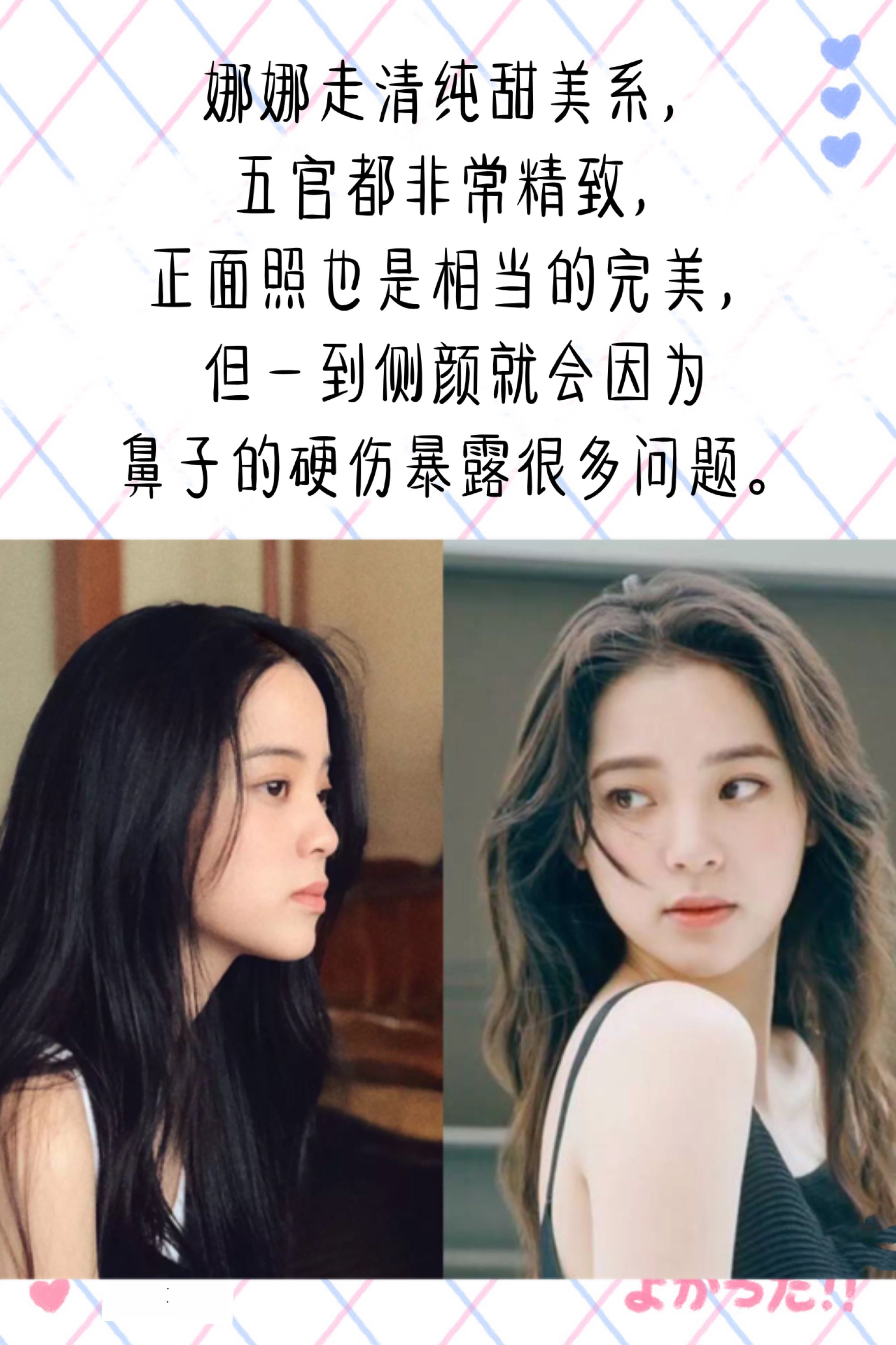 歐陽娜娜微調鼻子了嗎?