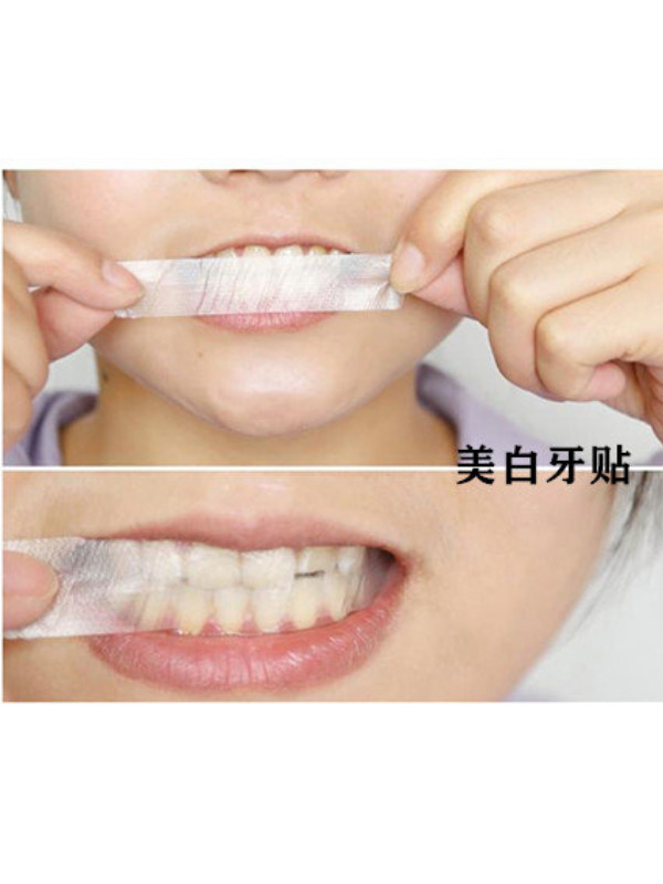牙贴面=美白牙贴?别在傻傻分不清楚了!