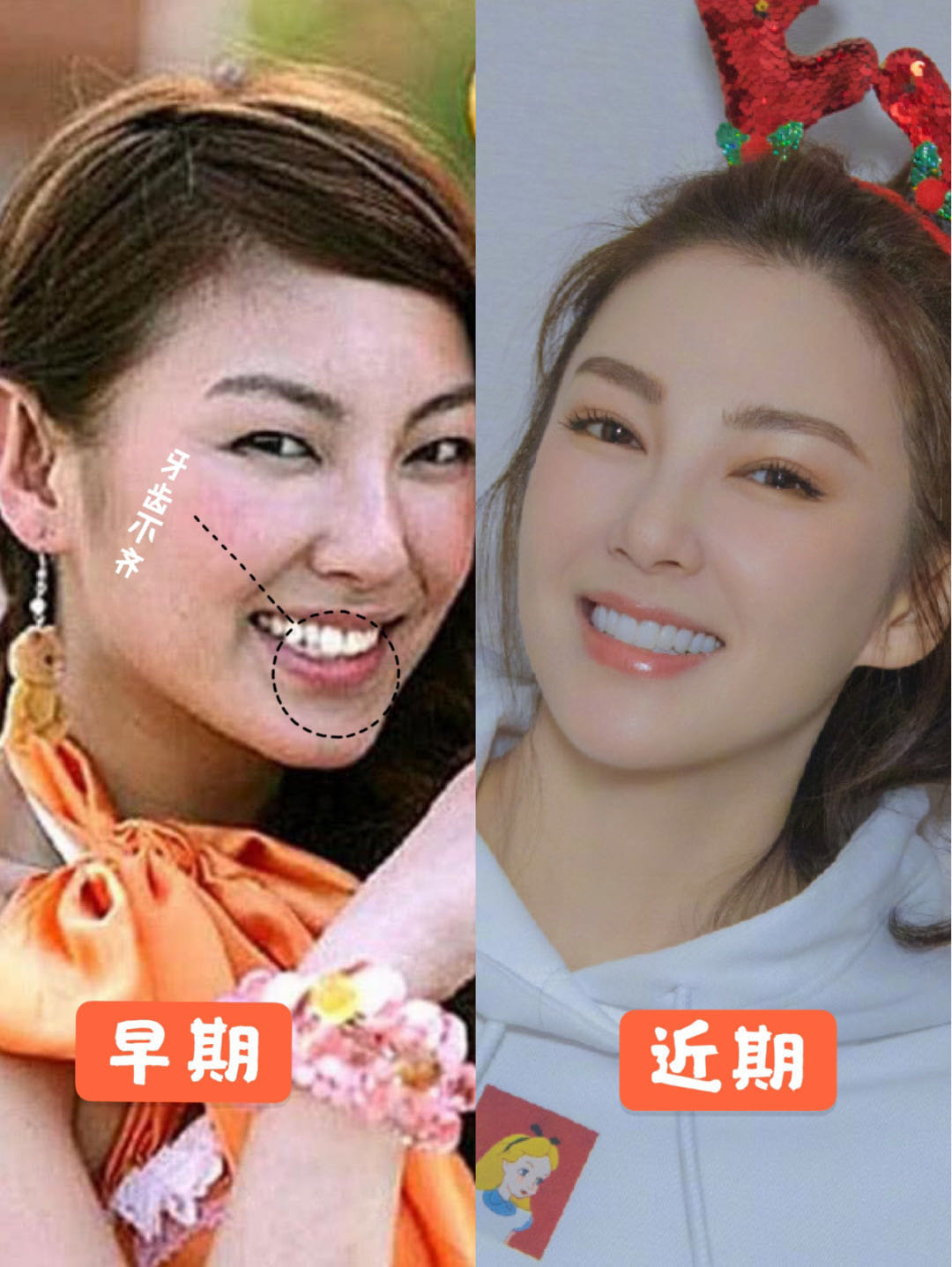 众所周知女_圈子-新氧美容整形