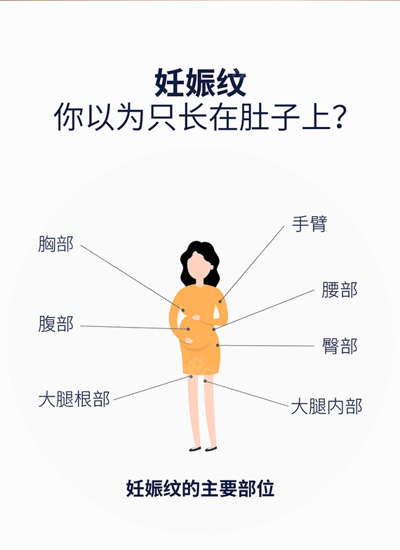 来看看妊娠纹吧,女生生孩子真的要考虑清楚