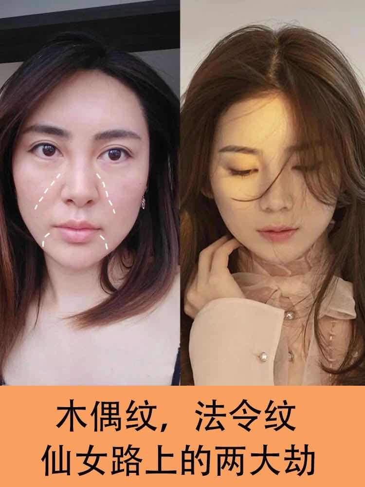 姑娘從正面看非常憔悴,法令紋明顯,側面看上去面部很鬆弛,而且雙