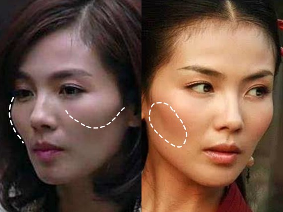 ①目测法 如果你能肉眼感觉到颧弓向斜前方45度的位置突出