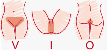 什么是vio私密脱毛?